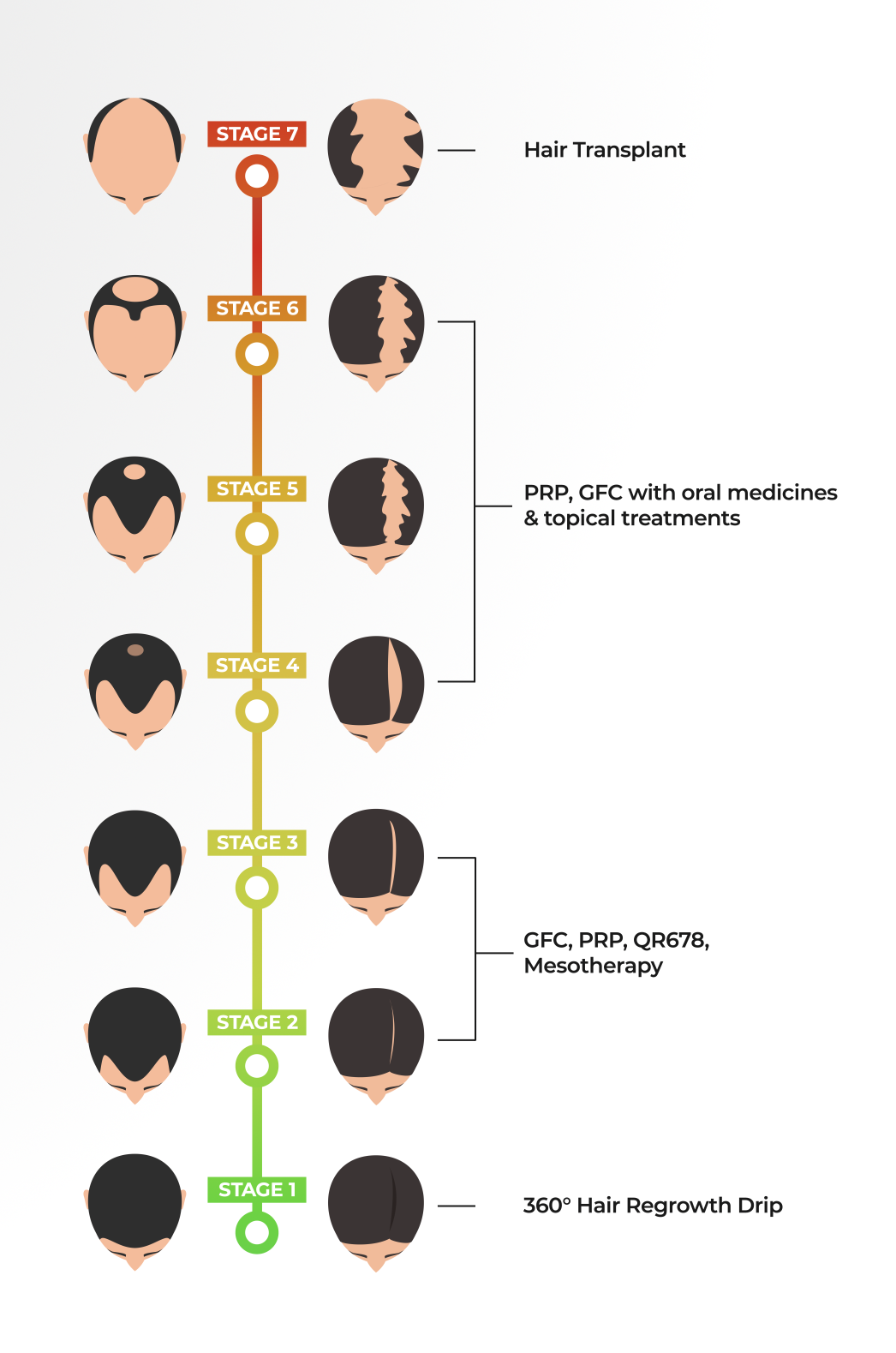 Understanding Hair Loss: A Guide to Its Stages and Treatments