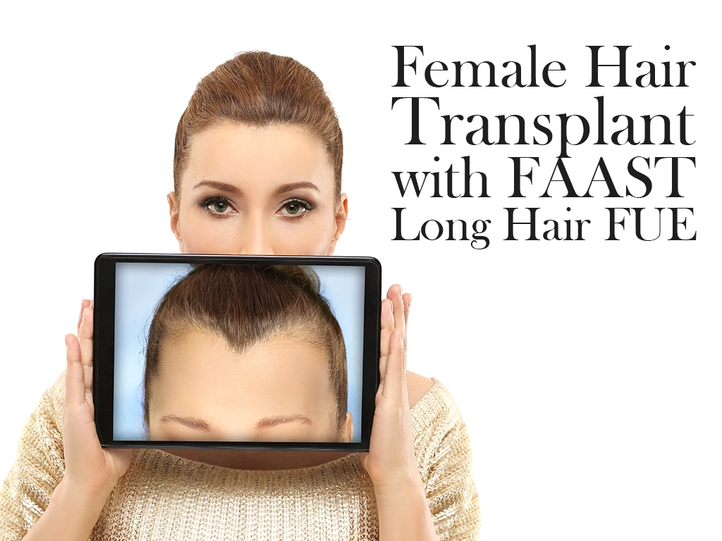 Female Hair Transplant with FAAST Long Hair FUE: Discreet, Natural & Confidence-Restoring 