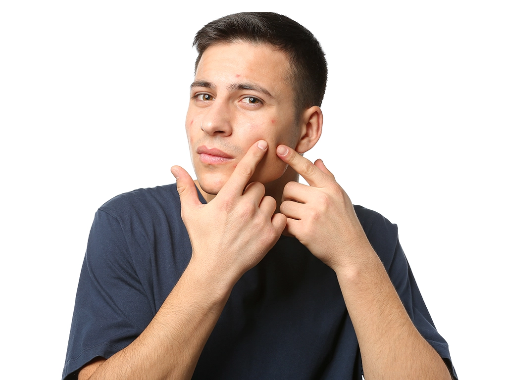 Hormonal Acne: What Actually Works