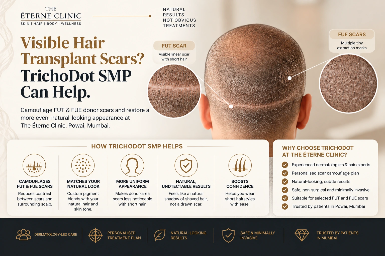TrichoDot SMP for Hair Transplant Scars in Mumbai: FUT & FUE Scar Camouflage