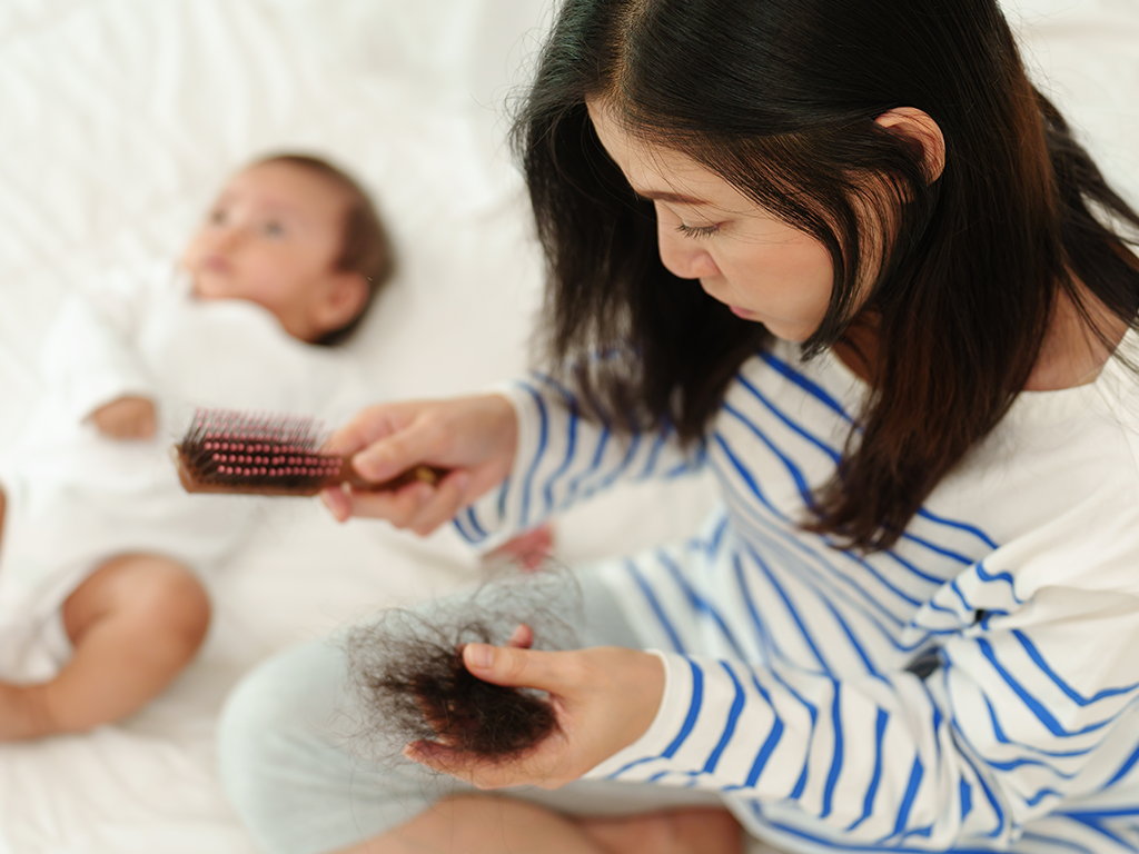 How To Stop Postpartum Hair Loss Effective Treatments And Tips 3628