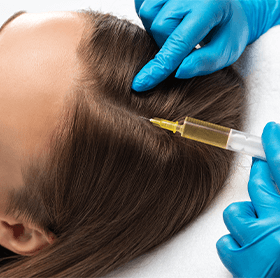 Hair Thinning Treatments at The Éterne Clinic