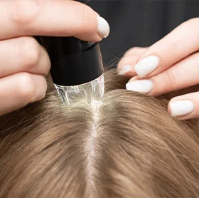 Hair Thinning Treatments at The Éterne Clinic