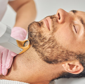 Laser Hair Removal Near Me: Face 