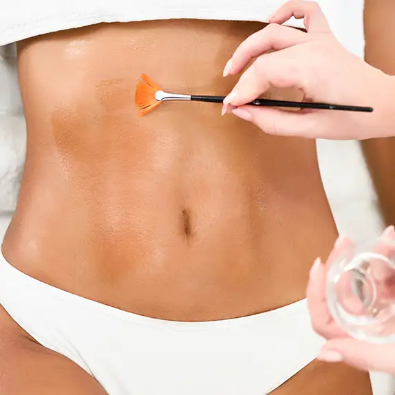 Stretch Marks
                                    Treatments at The Éterne Clinic