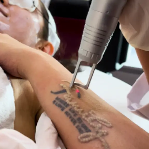 Tattoo Removal
                                    Treatments at The Éterne Clinic