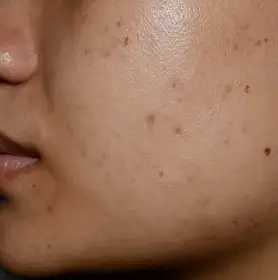 Vampire at The Éterne Clinic