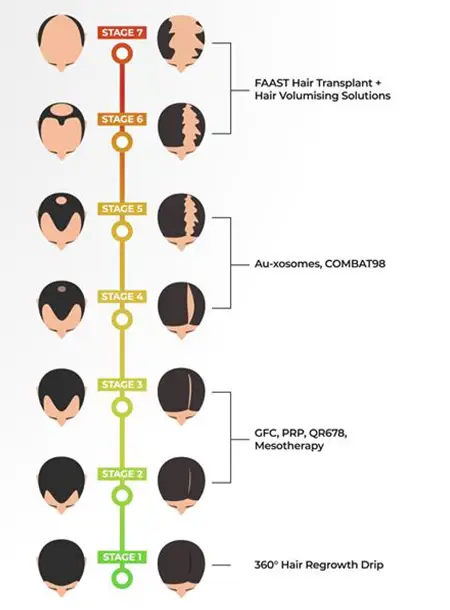 Seven Stage Of hair Loss